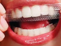 teeth whitener