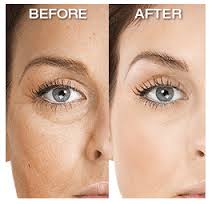 best revitol eye cream reviews