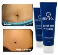 Finest stretch mark removal cream