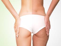 Best cellulite creams